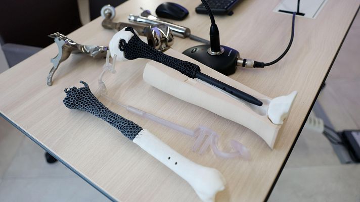 Informativo 24h - El Gregorio Marañón salva la pierna a un hombre con la primera prótesis personalizada de metamaterial del mundo