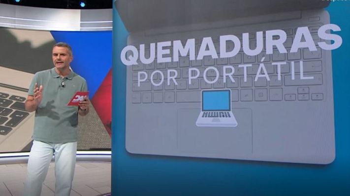 Directo al grano - Salud y vida: Las quemaduras en la piel que nos pueden producir los aparatos electrónicos