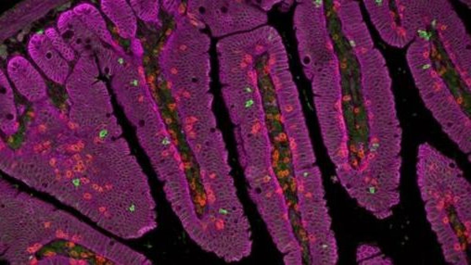La placenta se convierte en biofactoría contra heridas