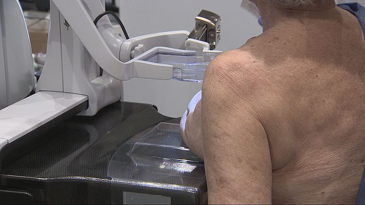 L'Informatiu - Dia Mundial del Càncer de Mama: la detecció precoç continua essent clau