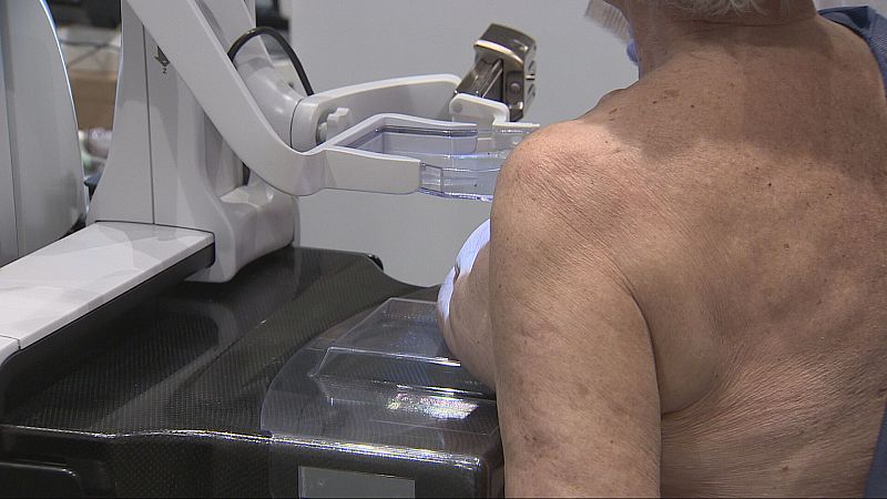 Paciente de espaldas durante una mamografía en una consulta médica con un equipo radiológico y pala de compresión.