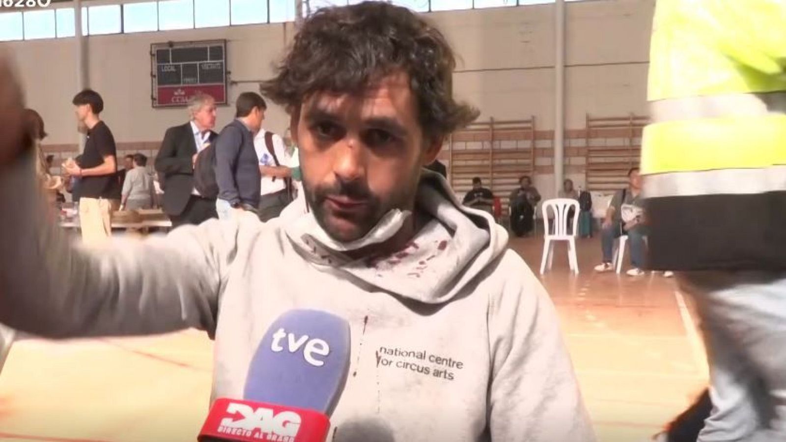 Hombre joven con expresión afectada y contusión en la nariz es entrevistado en un polideportivo ante un micrófono de Televisión Española.