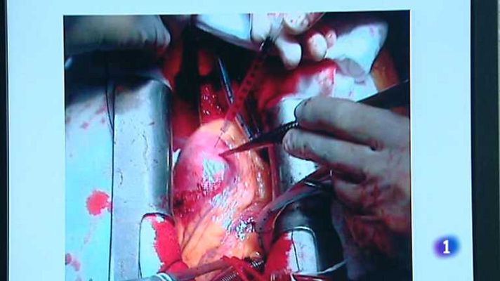 L'informatiu - Comunitat Valenciana - L'Informatiu - Comunitat Valenciana 2 - 24/04/13