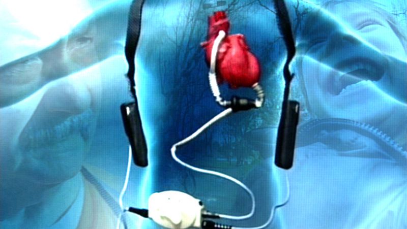 Documentos TV - Corazones artificiales. Impulsos de vida - Avance - Documentos TV | Ver