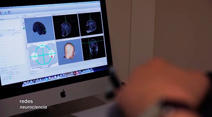 Redes - Estimula tu cerebro para vivir más