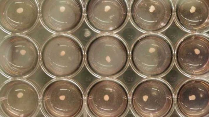 Telediario 1 - Hígado a partir de células madre