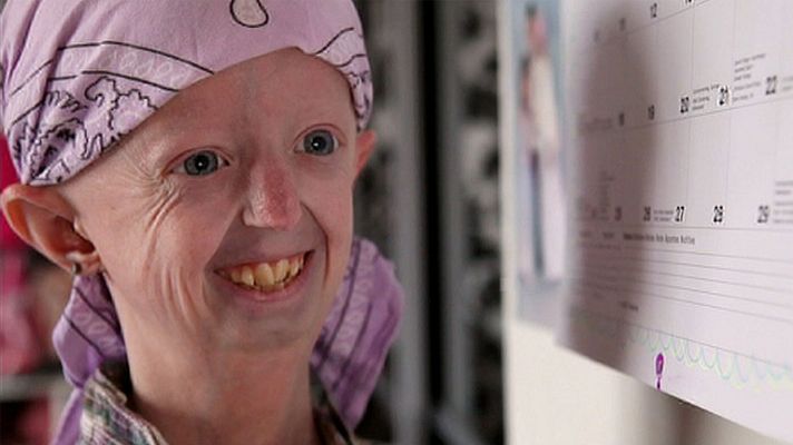 La noche temática - Mi enfermedad es rara - Avance