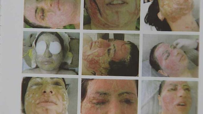 Telediario 1 - Regular la compra de ácido en India