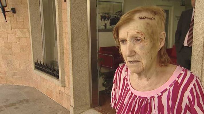 Telediario 1 - Volver a nacer con 87 años