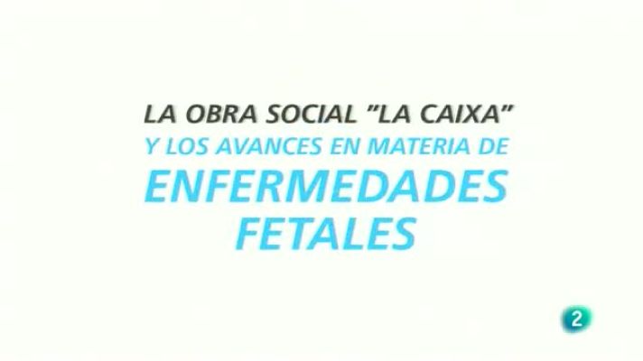 Para todos La 2 - Enfermedades fetales