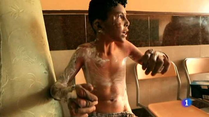 Informe Semanal - Informe Semanal - 31/08/13