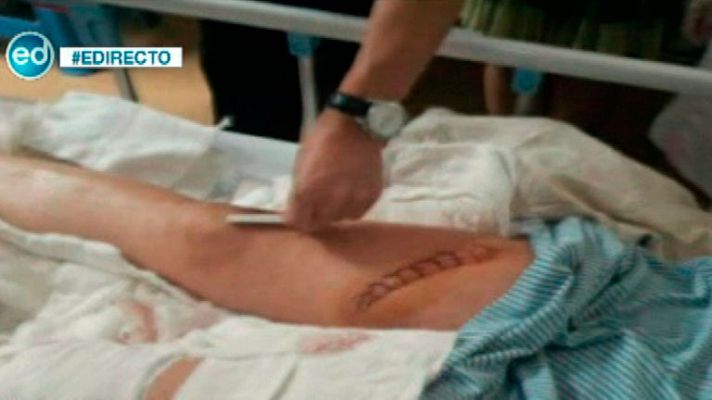 España Directo - Atacan catana española aeropuerto