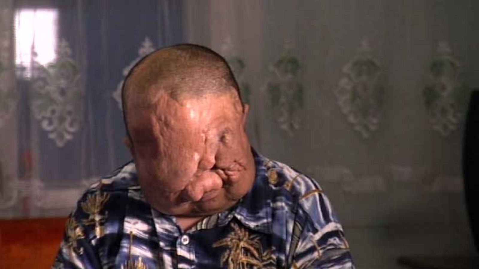 En Portada - Hijos de la guerra atómica - Avance - En portada | Ver