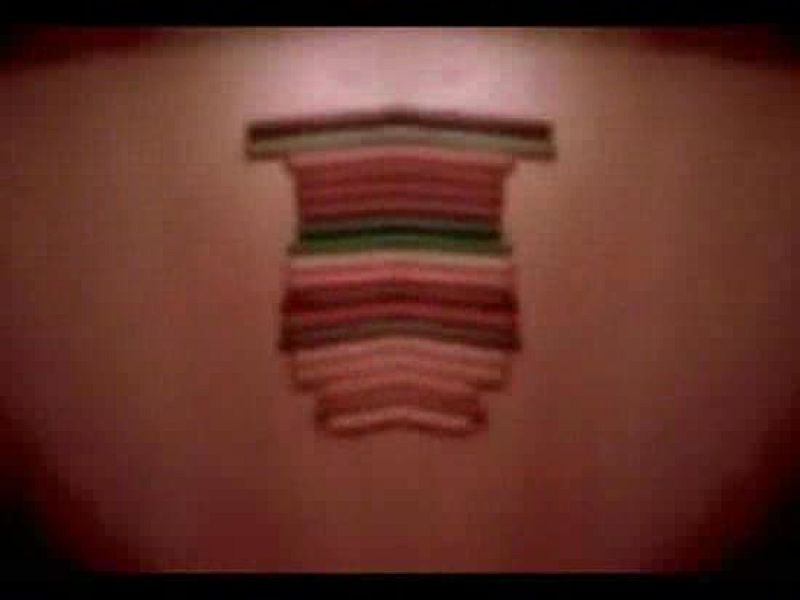 Spot Radio 3 (Pablo Pehache) | Ver