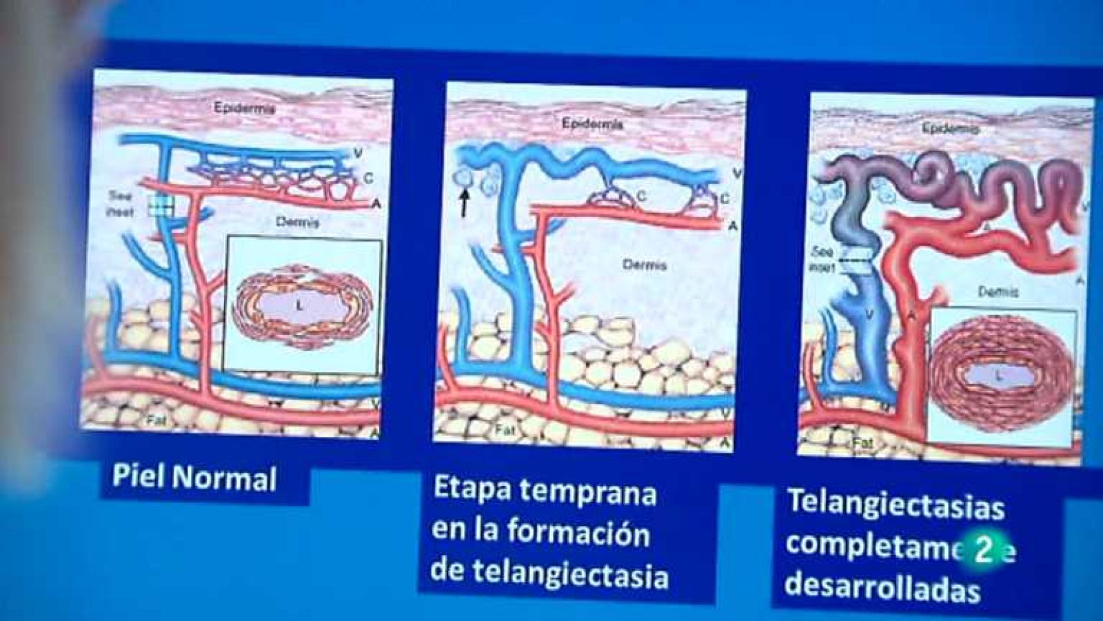 Para todos La 2 - 24/10/13 - Ver ahora