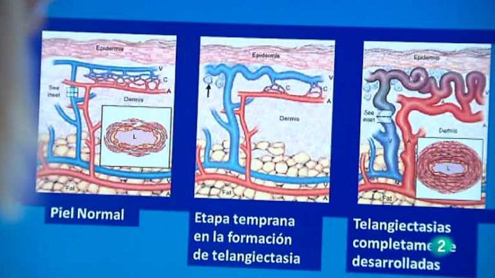 Para todos La 2 - Para todos La 2 - 24/10/13