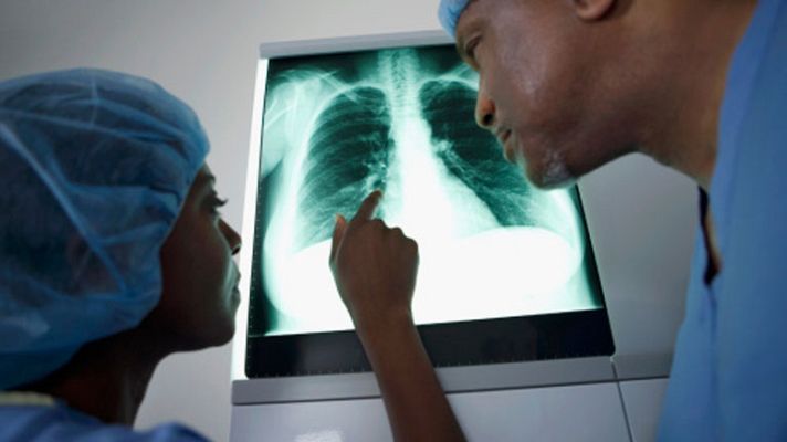 La mañana - Insuficiencia respiratoria