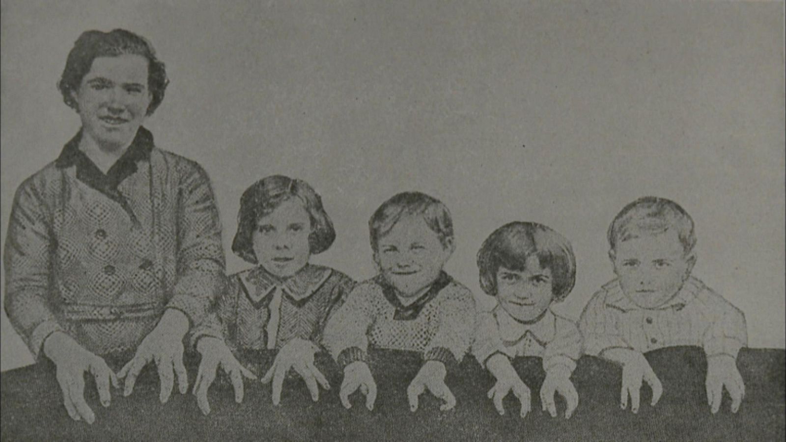 Documentos TV - Higiene racial - Comienzo - Documentos TV | Ver