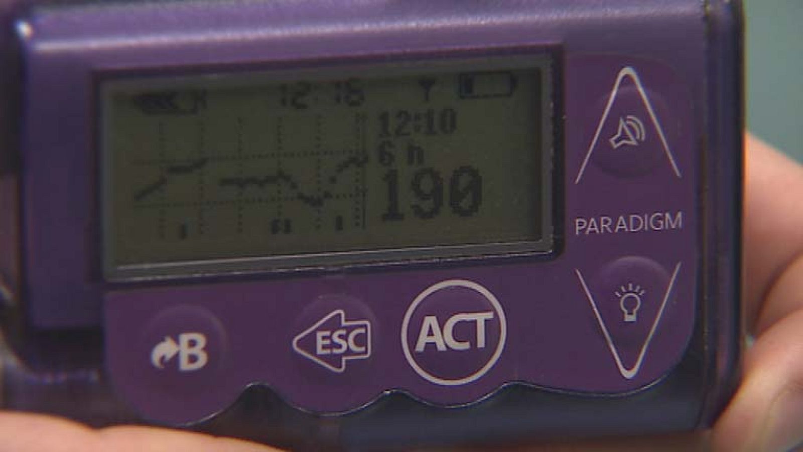 Más de cinco millones de españoles padecen diabetes