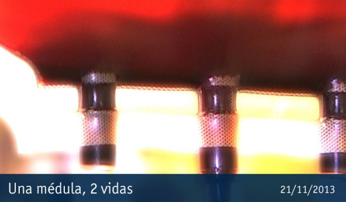 Crónicas - Cronicas - Una médula 2 vidas - Avance