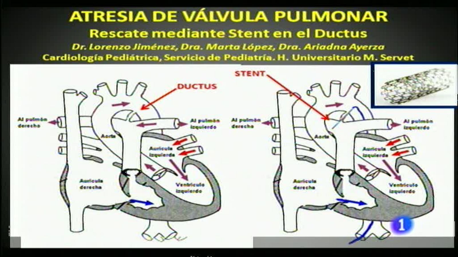 Noticias Aragón 2 - 25/11/13 | Ver