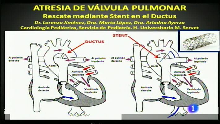 Noticias Aragón - Noticias Aragón 2 - 25/11/13