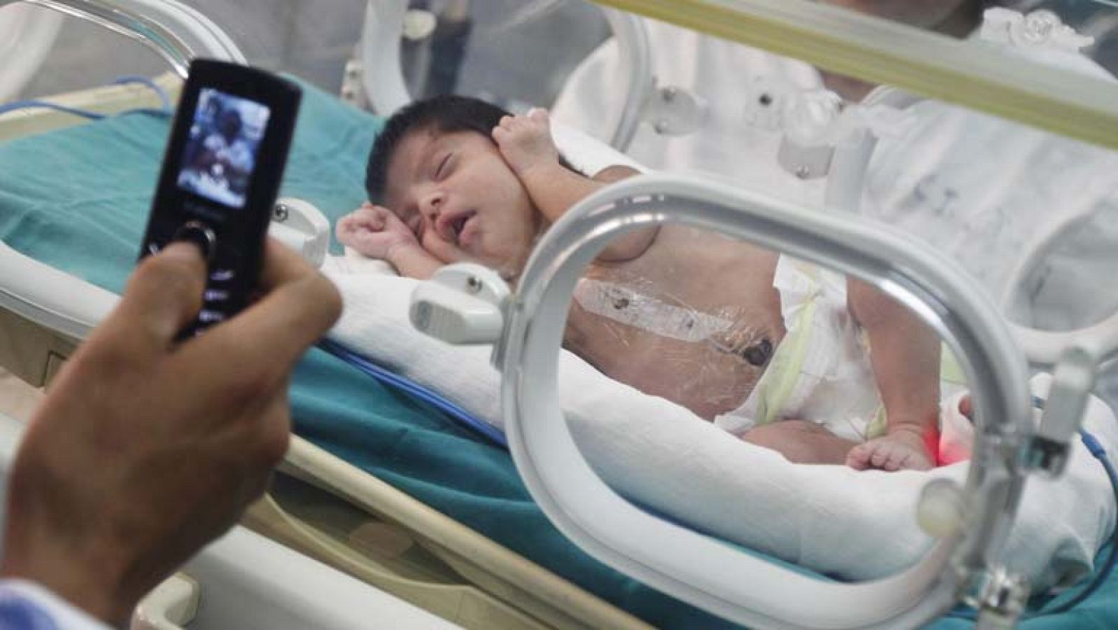 Las cardiopatías afectan a ocho de cada mil nacidos en todo el mundo