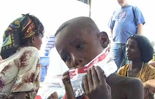  - 20 millones de niños padecen hambre