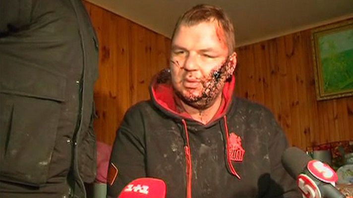 Informativo 24h - Reaparece con signos de tortura el opositor ucraniano Dimitry Bulatov
