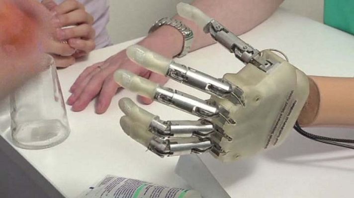 Telediario 1 - Mano biónica