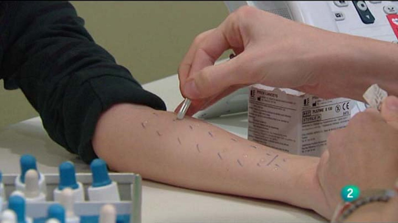 Para Todos La 2 - Vídeo - Alergias alimentarias