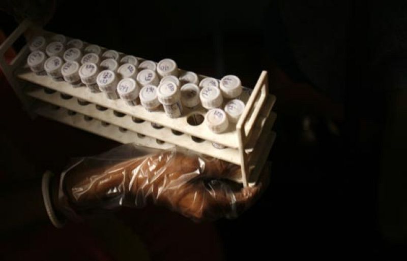 La situación del sida en el mundo en 2008