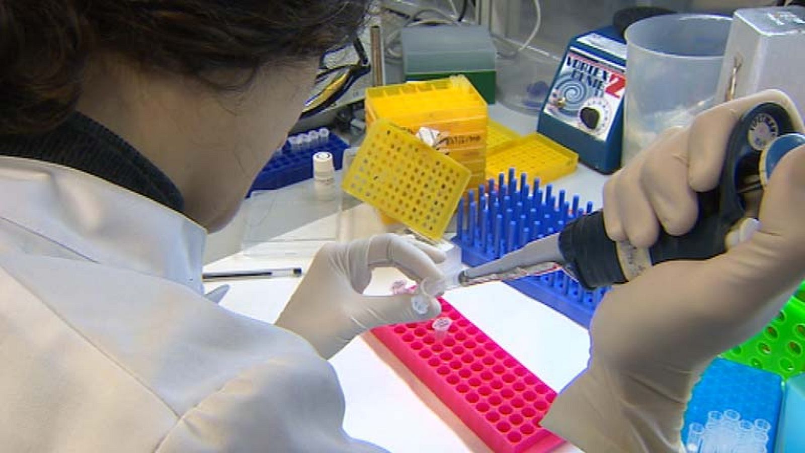 El Centro de Investigaciones Oncológicas abre una nueva vía para combatir la soriasis