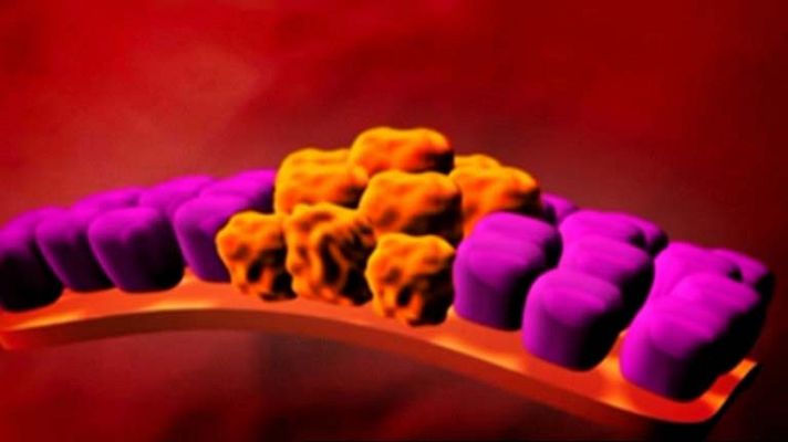 Telediario 1 - Proceso de la metástasis