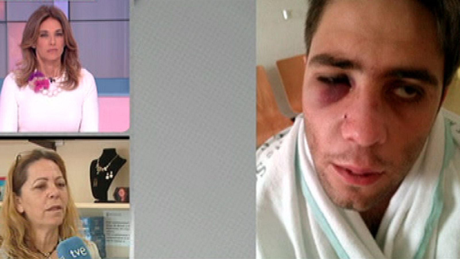 Brutal paliza a un discapacitado psíquico