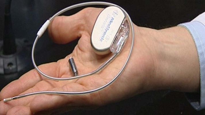 Telediario 1 - Prueban en Barcelona el marcapasos más pequeño del mundo