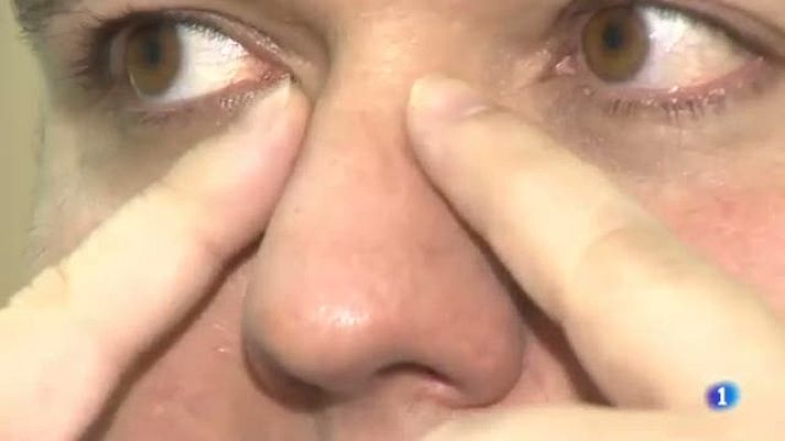 L'Informatiu - La nova al·lèrgia provocada per combianr exercici físic i una proteína del blat