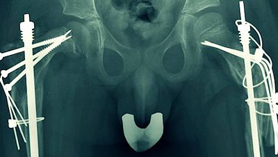 Documentos TV - Avance: 'Frgil. Un camino de cristal'