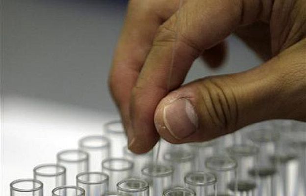  - Avance español contra el Alzheimer