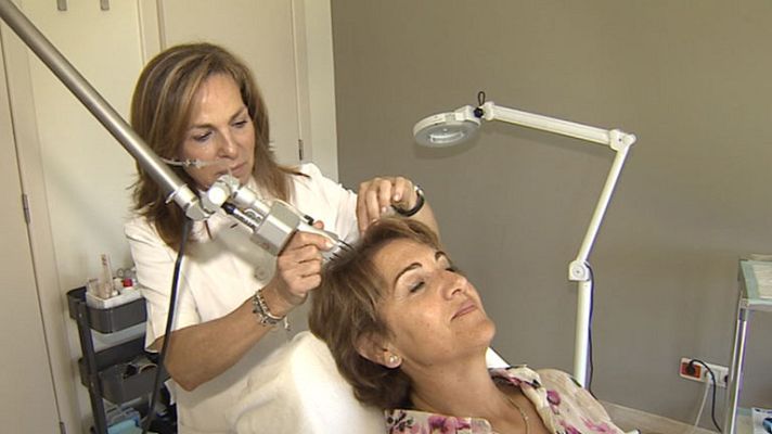 Telediario 1 - Más de un 20% de las mujeres padece calvicie
