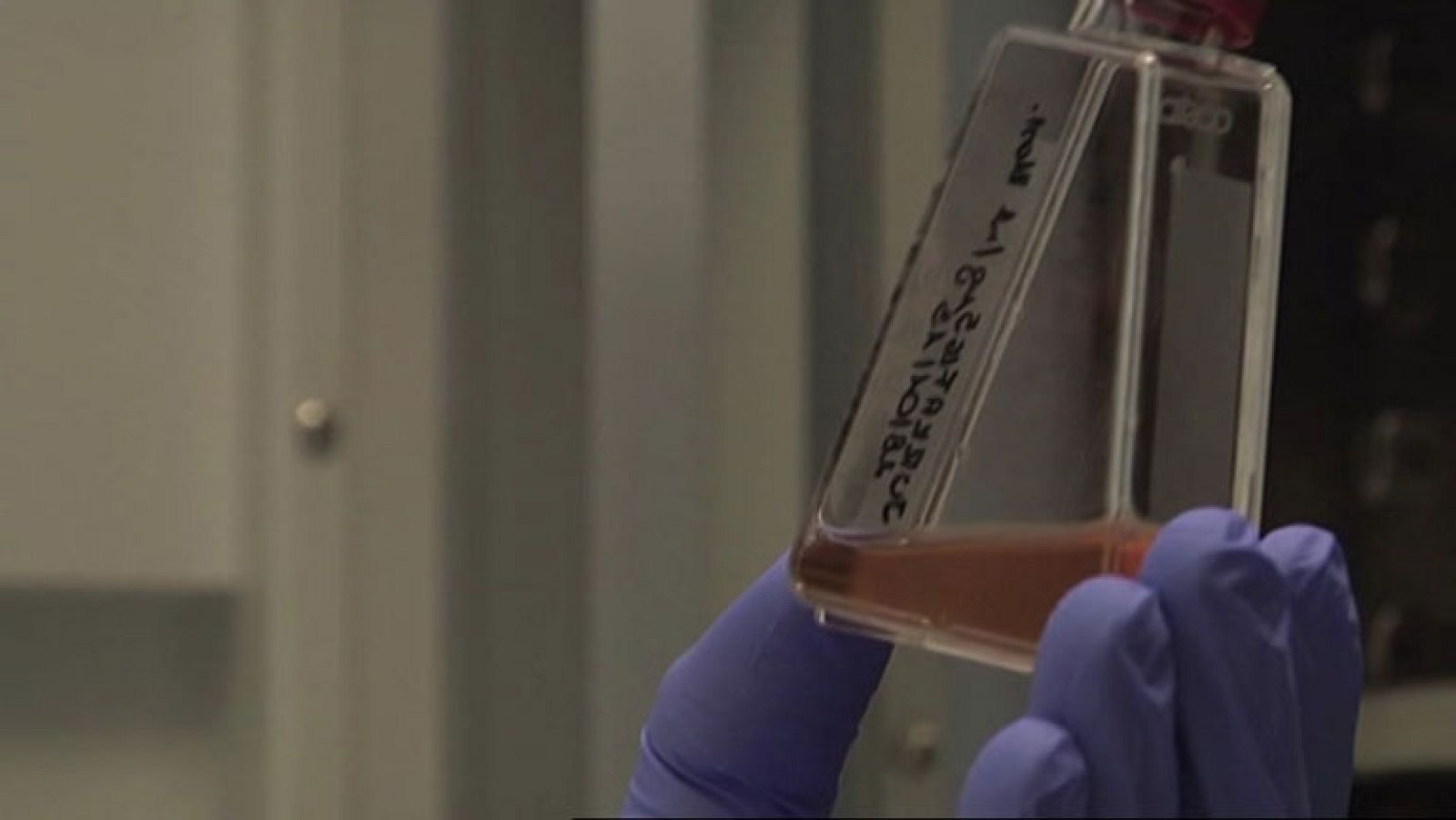 Un gel podría ser la solución a la infección vía sexual del VIH, el virus del Sida.