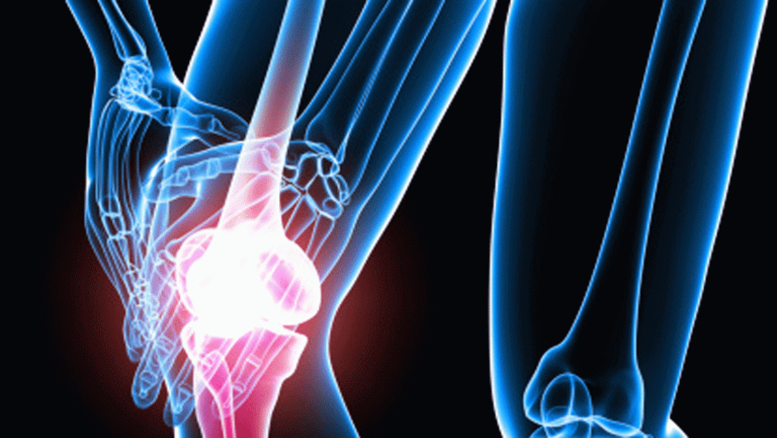 Saber vivir - Huesos fuertes en verano