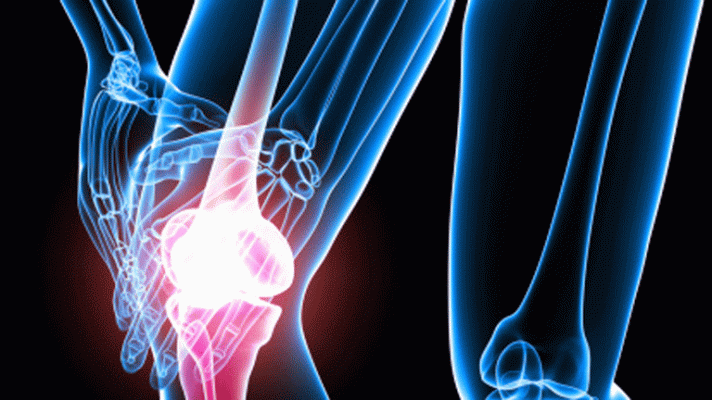 La mañana - Huesos fuertes en verano