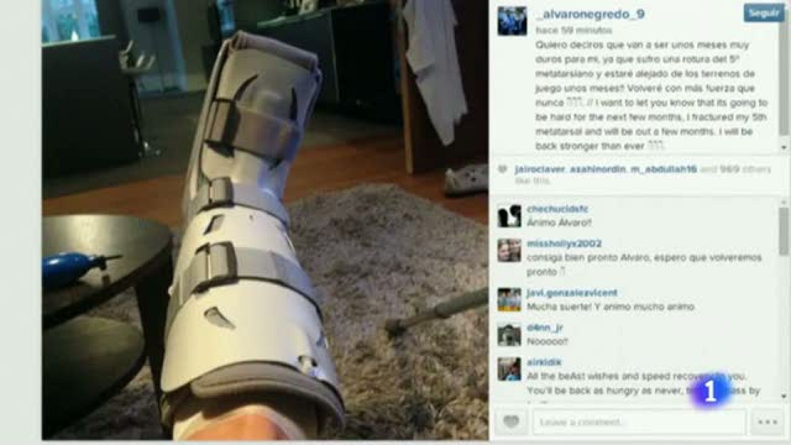 Negredo, sin jugar durante "unos meses" por una fractura de metatarsiano | Ver