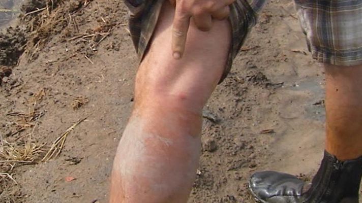 Telediario 1 - En verano llegan a muchos lugares las plagas de mosquitos