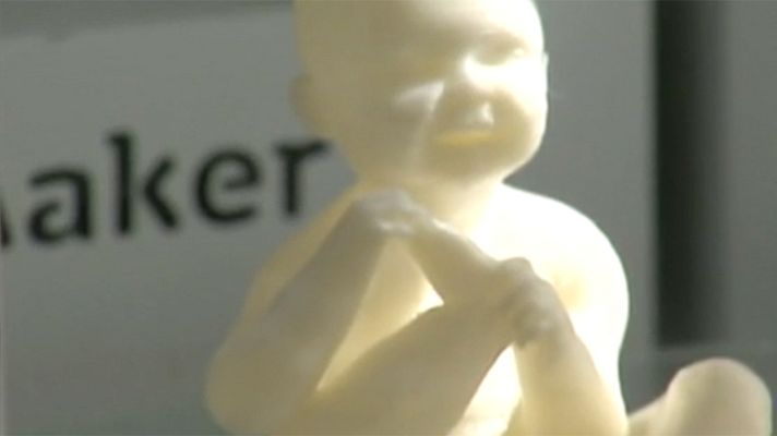  - Ecografías de bebés en 3D