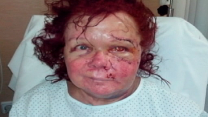 España Directo - Una mujer de 68 años recibe una paliza en el portal de casa