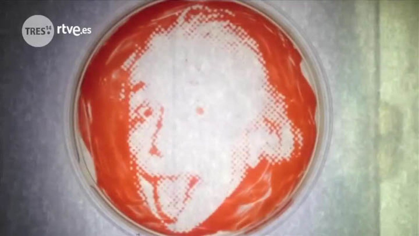 Tres14 - Fotografías con bacterias