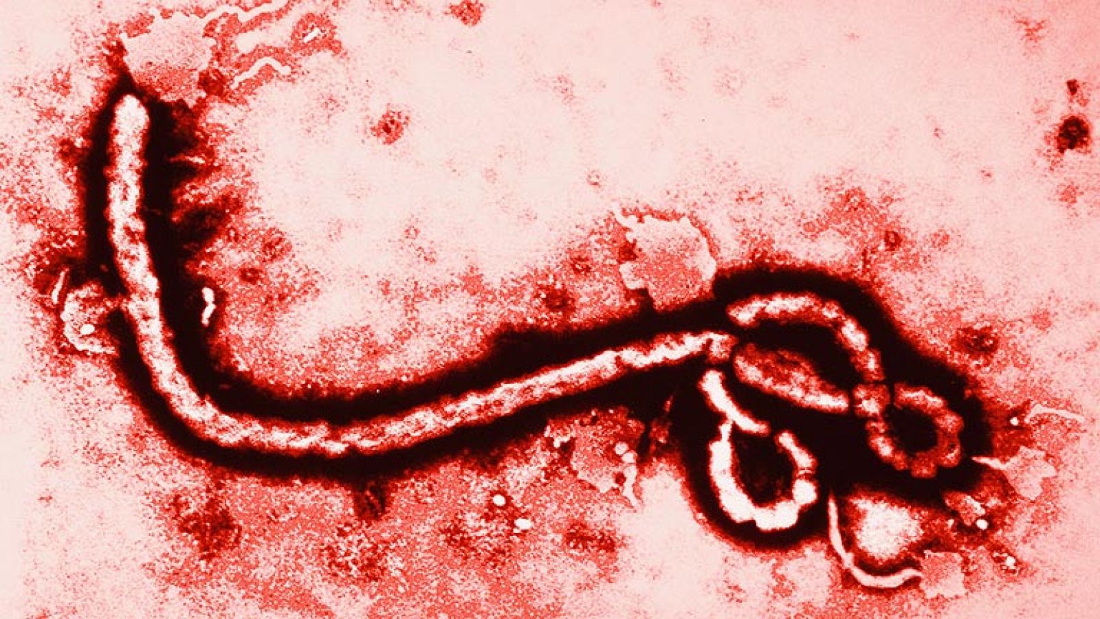 ¿Cómo se contagia el virus del ébola?