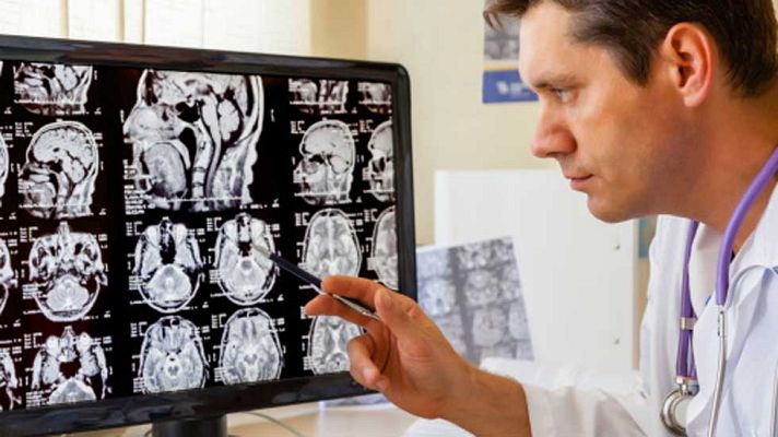 La mañana - Radiografía para un cerebro sano